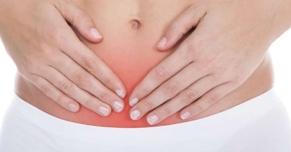 Cirurgia de Endometriose Quando é necessária